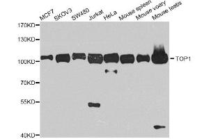 Western blot analysis of extracts of various cell lines, using TOP1 antibody. (Topoisomerase I Antikörper)