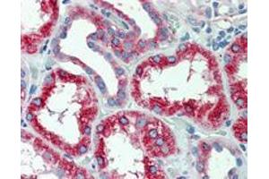 Immunohistochemistry (Formalin/PFA-fixed paraffin-embedded sections) of human kidney with SLC11A2 polyclonal antibody .