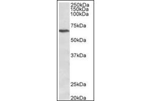Staining of Jurkat lysate (35µg protein in RIPA buffer) using CACNB2 antibody at 1 µg/ml. (CACNB2 Antikörper  (C-Term))