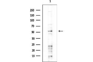 anti-Calcium/calmodulin-Dependent Protein Kinase Kinase 1, alpha (CAMKK1) (C-Term) antibody