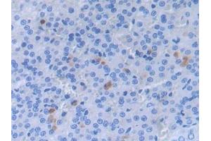 Detection of a2PI in Rat Adrenal gland Tissue using Polyclonal Antibody to Alpha 2-Antiplasmin (a2PI) (a2PI (AA 348-491) Antikörper)