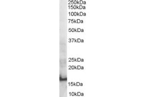 Image no. 1 for anti-SH2 Domain Containing 1A (SH2D1A) (Internal Region) antibody (ABIN374582) (SH2D1A Antikörper  (Internal Region))