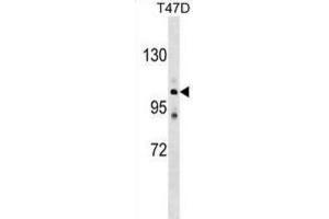 Western Blotting (WB) image for anti-ATPase, Ca++ Transporting, Type 2C, Member 1 (ATP2C1) antibody (ABIN2999252) (ATP2C1 Antikörper)