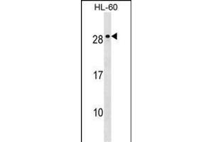 MED18 Antibody (C-term) (ABIN1536799 and ABIN2849776) western blot analysis in HL-60 cell line lysates (35 μg/lane). (MED18 Antikörper  (C-Term))