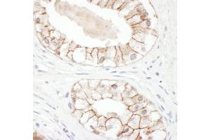 Immunohistochemistry (IHC) image for anti-Junction Plakoglobin (JUP) (AA 695-745) antibody (ABIN7454953)