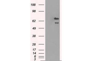 HEK293T cells were transfected with the pCMV6-ENTRY control (Left lane) or pCMV6-ENTRY HSPA9 (Right lane) cDNA for 48 hrs and lysed. (HSPA9 Antikörper)