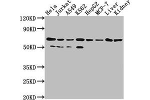 Western Blot Positive WB detected in: Hela whole cell lysate, Jurkat whole cell lysate, A549 whole cell lysate, HepG2 whole cell lysate, MCF-7 whole cell lysate, Rat liver tissue, Rat kidney tissue All lanes: AIFM1 antibody at 1:2000 Secondary Goat polyclonal to rabbit IgG at 1/50000 dilution Predicted band size: 67, 36, 29, 27 kDa Observed band size: 67 kDa (Rekombinanter AIF Antikörper)