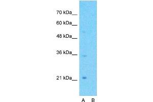 Host:  Rabbit  Target Name:  GPCR5A  Sample Type:  Jurkat  Lane A:  Primary Antibody  Lane B:  Primary Antibody + Blocking Peptide  Primary Antibody Concentration:  1ug/ml  Peptide Concentration:  5ug/ml  Lysate Quantity:  25ug/lane/lane  Gel Concentration:  0. (GPRC5A Antikörper  (C-Term))