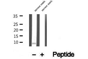 Western blot analysis of extracts of mouse testis tissue, using TNP1 antibody.