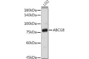 Western blot analysis of extracts of LO2 cells, using  antibody (ABIN3022642, ABIN3022643, ABIN3022644 and ABIN6219013) at 1:1000 dilution. (ABCG8 Antikörper  (AA 1-320))