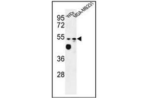 Western blot analysis of Tricellulin Antibody (C-term) in WiDr, MDA-MB231 cell line lysates (35ug/lane).