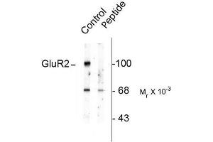 Image no. 1 for anti-Glutamate Receptor, Ionotropic, AMPA 2 (GRIA2) (pSer880) antibody (ABIN372656) (GRIA2 Antikörper  (pSer880))