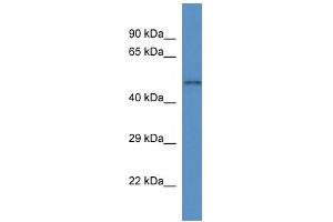 WB Suggested Anti-Slc35f3 Antibody   Titration: 1. (SLC35F3 Antikörper  (C-Term))