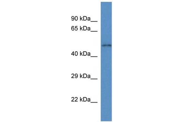 SLC35F3 Antikörper  (C-Term)