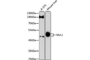 Western blot analysis of extracts of various cell lines, using MUL1 antibody (ABIN6133239, ABIN6144199, ABIN6144200 and ABIN6217001) at 1:3000 dilution. (MUL1 Antikörper  (AA 1-352))
