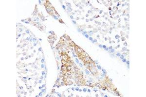 Immunohistochemistry of paraffin-embedded Mouse testis leydig using Fibronectin Polyclonal Antibody at dilution of 1:100 (40x lens). (Fibronectin Antikörper)