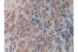 Immunohistochemistry (IHC) image for anti-R-Spondin 1 (RSPO1) (AA 21-135) antibody (ABIN7430144)