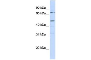 Western Blotting (WB) image for anti-Kringle Containing Transmembrane Protein 1 (KREMEN1) antibody (ABIN2458904) (KREMEN1 Antikörper)