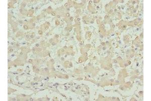 Immunohistochemistry (IHC) image for anti-Inhibin, beta B (INHBB) (AA 295-405) antibody (ABIN7156239)