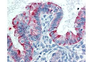 Anti-TNFRSF14 / CD270 antibody IHC of human uterus. (HVEM Antikörper  (AA 38-284))