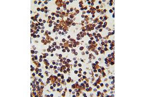 Formalin-fixed and paraffin-embedded human lymph tissue reacted with FOXP3 antibody (C-term), which was peroxidase-conjugated to the secondary antibody, followed by DAB staining. (FOXP3 Antikörper  (C-Term))