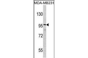 Western blot analysis of DLGAP1 Antibody in MDA-MB231 cell line lysates (35ug/lane)