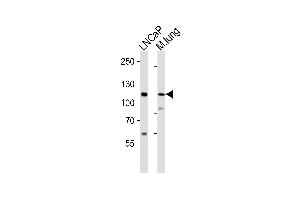 Western blot analysis of lysates from LNCaP cell line, mouse lung tissue lysate(from left to right), using PRDM16 Antibody (Center) (ABIN6242535 and ABIN6577602). (PRDM16 Antikörper  (AA 771-804))