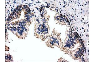Immunohistochemistry (IHC) image for anti-Striatin Interacting Protein 1 (STRIP1) antibody (ABIN1498205) (STRIP1 Antikörper)