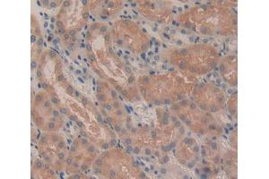 Used in DAB staining on fromalin fixed paraffin- embedded Kidney tissue (CROT Antikörper  (AA 410-612))