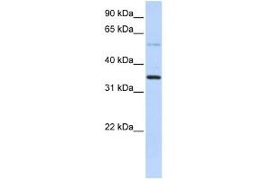 WB Suggested Anti-ANKRD9 Antibody Titration: 0.
