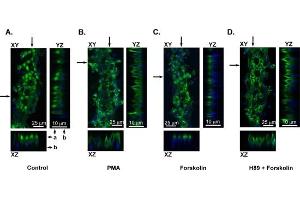 PKA activation causes TRPV4 subcellular translocation.