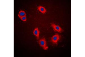 Immunofluorescent analysis of Cytokeratin 18 (pS33) staining in A431 cells. (Cytokeratin 18 Antikörper  (N-Term, pSer33))