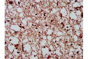 IHC image of ABIN7146885 diluted at 1:300 and staining in paraffin-embedded human brain tissue performed on a Leica BondTM system.