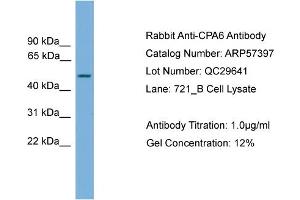 WB Suggested Anti-CPA6  Antibody Titration: 0. (CPA6 Antikörper  (Middle Region))