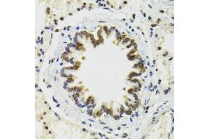 Immunohistochemistry of paraffin-embedded rat lung using RUVBL2 antibody. (RUVBL2 Antikörper  (AA 1-463))