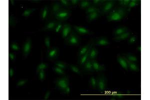 Immunofluorescence of monoclonal antibody to MAK on HeLa cell. (MAK Antikörper  (AA 358-457))