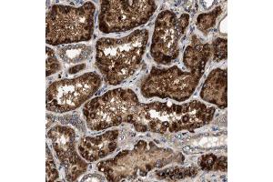 Immunohistochemical staining (Formalin-fixed paraffin-embedded sections) of human kidney using DUSP10 polyclonal antibody  shows strong cytoplasmic positivity with granular pattern in renal tubules. (DUSP10 Antikörper  (AA 180-291))