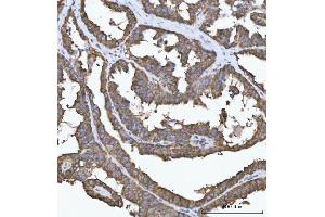 IHC analysis of FADS1 using anti-FADS1 antibody (ABIN7599175). (FADS1 Antikörper  (AA 1-257))
