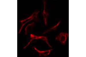 ABIN6269254 staining Hela cells by IF/ICC.