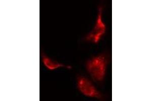 Immunofluorescence (fixed cells) (IF/ICC) image for anti-Protein Phosphatase 2, Regulatory Subunit B'', gamma (PPP2R3C) (C-Term) antibody (ABIN6259560)