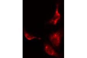 ABIN6275550 staining  HuvEc cells by IF/ICC.