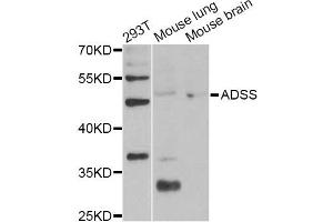 Western blot analysis of extracts of various cell lines, using ADSS Antibody (ABIN6292806) at 1:1000 dilution. (ADSS Antikörper)