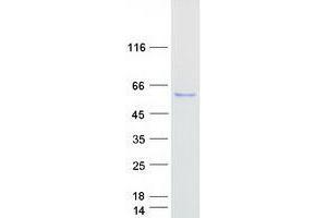 TTI2 Protein (Transcript Variant 2) (Myc-DYKDDDDK Tag)