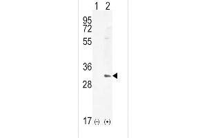 Western blot analysis of HMOX1 (arrow) using rabbit polyclonal HMOX1 Antibody (Center) (ABIN655187 and ABIN2844803). (HMOX1 Antikörper  (AA 177-204))