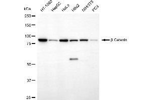 Western blotting analysis using β catenin antibody (ABIN7797936). (Rekombinanter beta Catenin Antikörper)