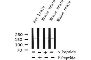 Western blot analysis of Phospho-Ret (Tyr1062) expression in various lysates (Ret Proto-Oncogene Antikörper  (pTyr1062))