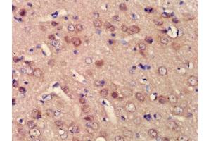 Formalin-fixed and paraffin embedded rat brain labeled with Rabbit Anti-BPTF/FALZ Polyclonal Antibody, Unconjugated (ABIN1386560) at 1:200 followed by conjugation to the secondary antibody and DAB staining (BPTF Antikörper  (AA 2801-3046))