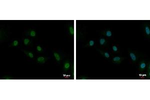 ICC/IF Image UBE2C antibody [N1C3] detects UBE2C protein at cytoplasm and nucleus by immunofluorescent analysis. (UBE2C Antikörper)