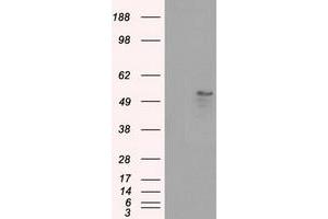 Western Blotting (WB) image for anti-Solute Carrier Family 2 (Facilitated Glucose/fructose Transporter), Member 5 (SLC2A5) antibody (ABIN1498475) (SLC2A5 Antikörper)