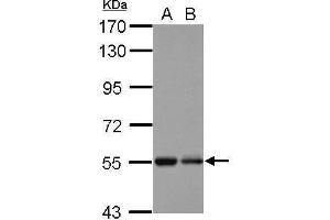 WB Image Sample (30 ug of whole cell lysate) A: U87-MG B: SK-N-SH 7. (KBTBD4 Antikörper  (Center))